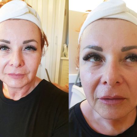 ProCeA | Vorher-Nachher